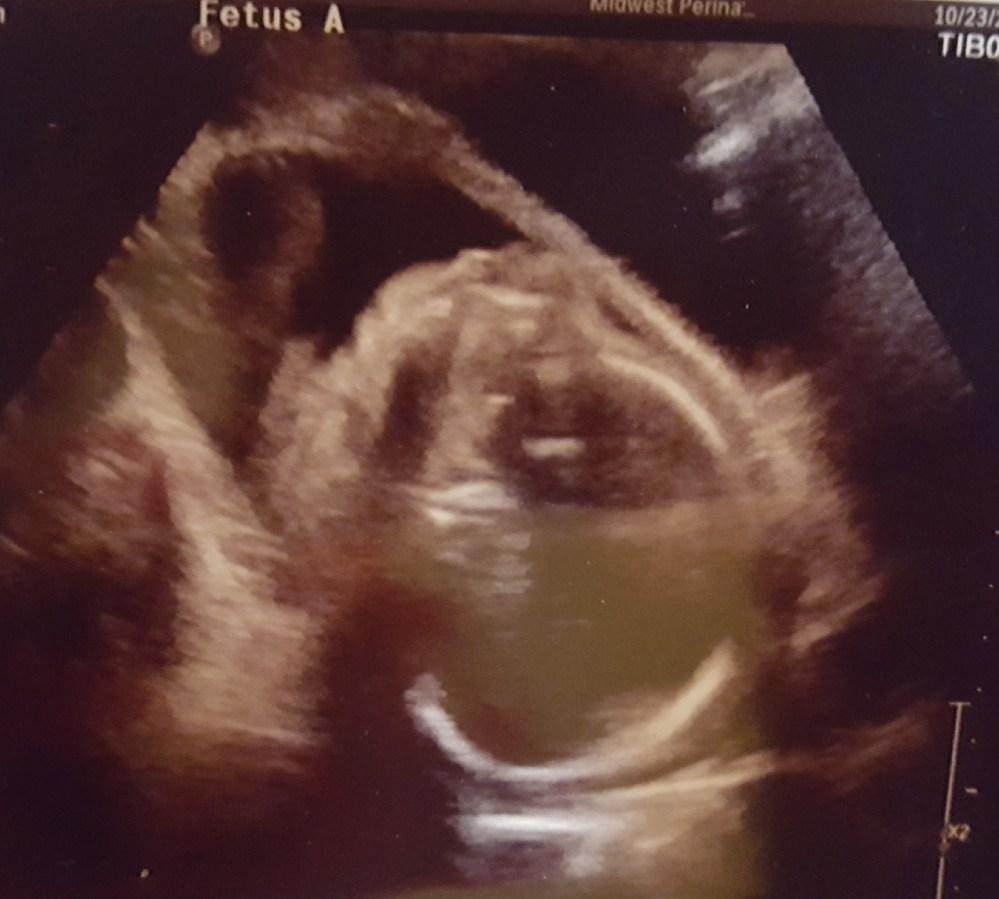 Resized_20171102_183727