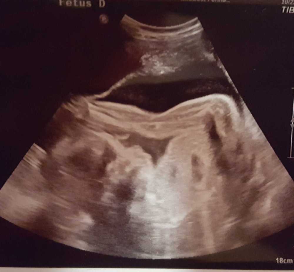 Resized_20171102_190334