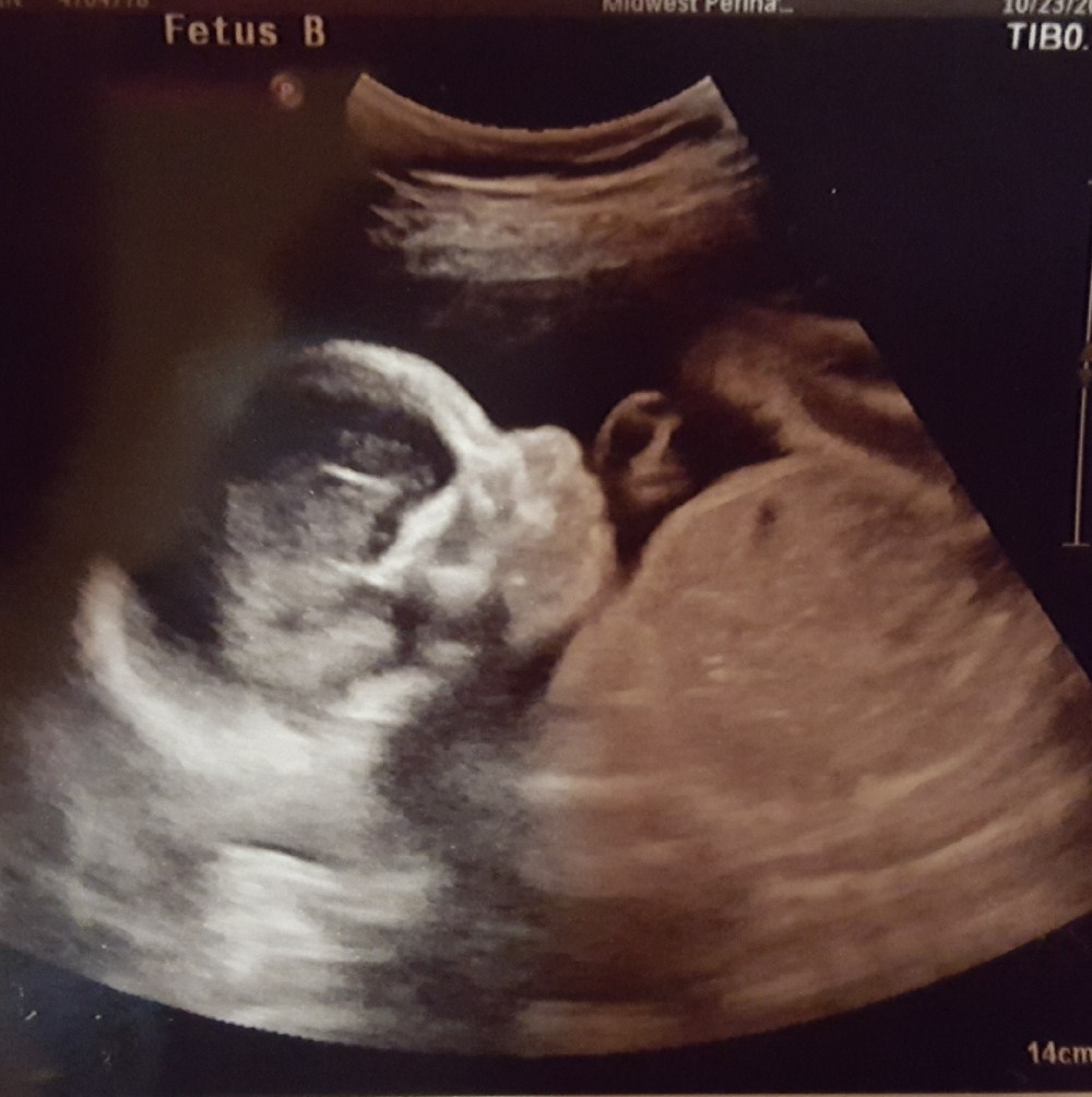 Resized_20171102_190412