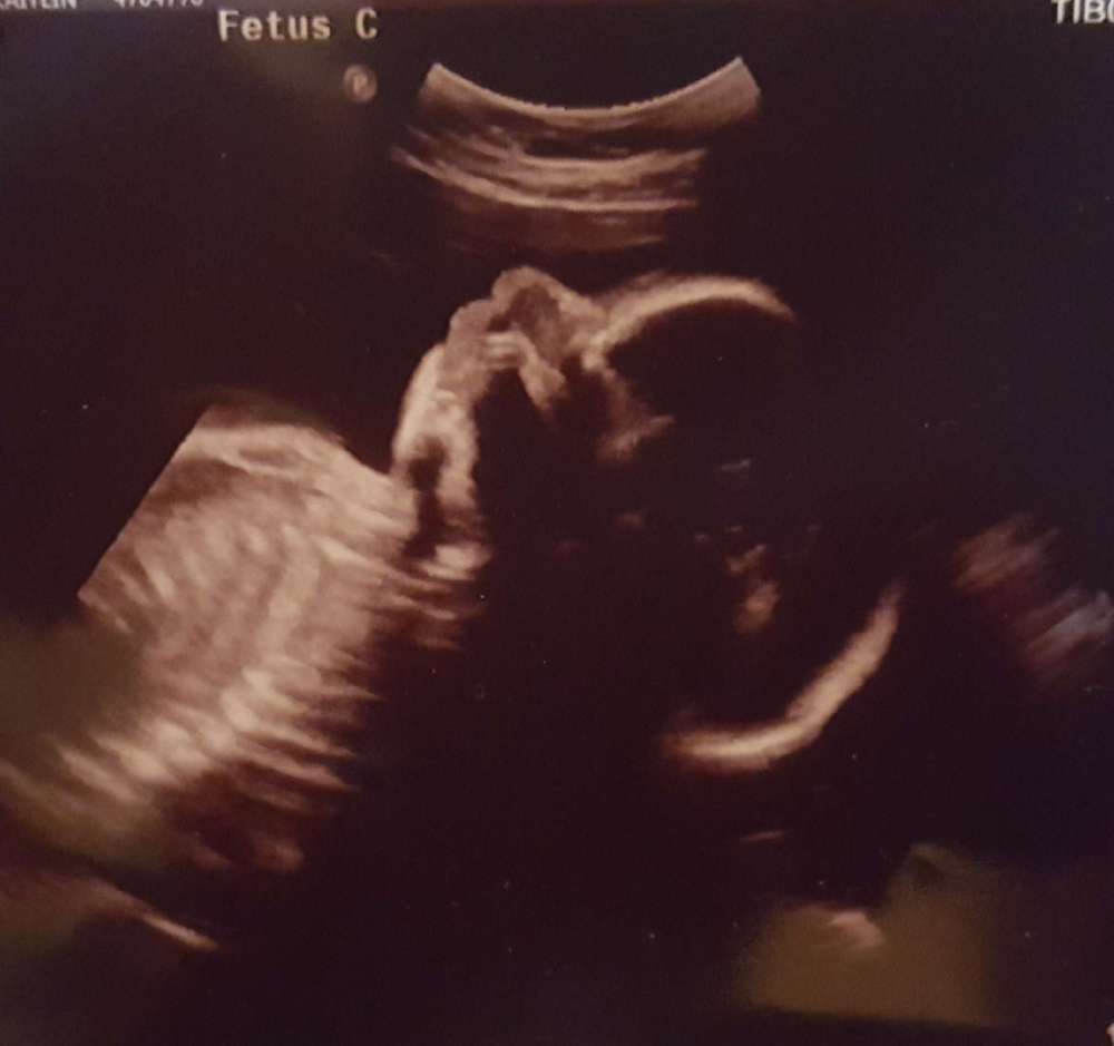 Resized_20171102_190428