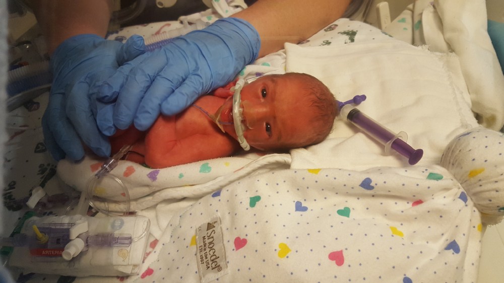 Resized_20171118_162535